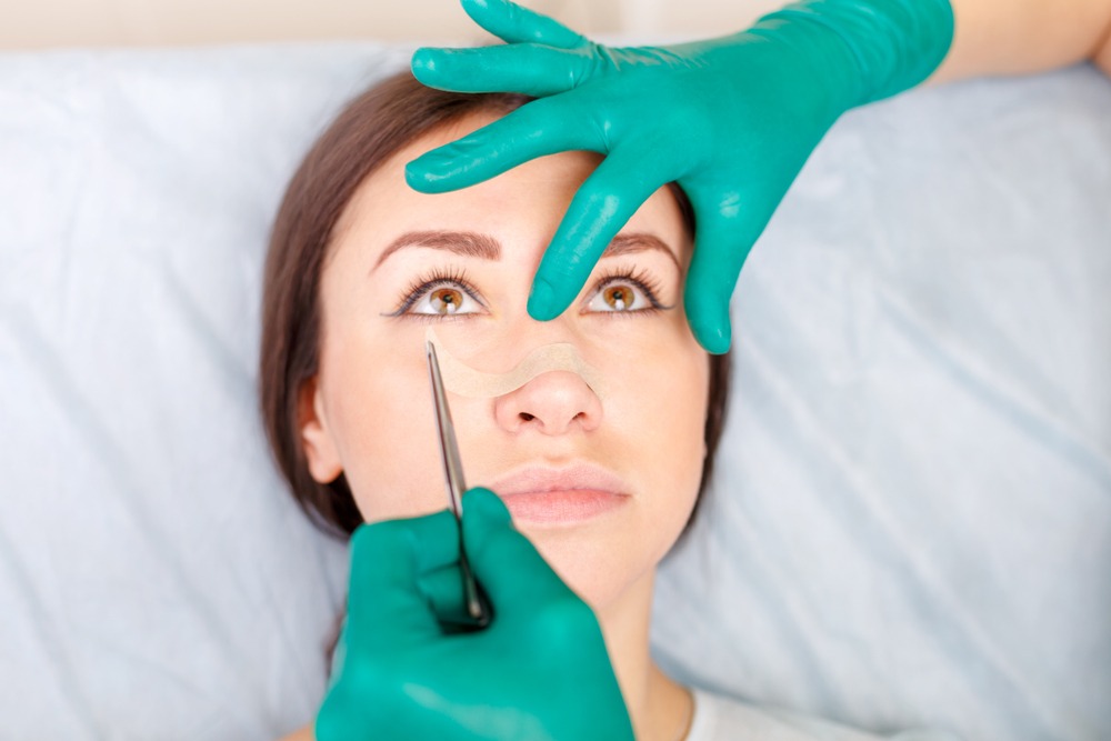 postoperatorio blefaroplastia superior e inferior