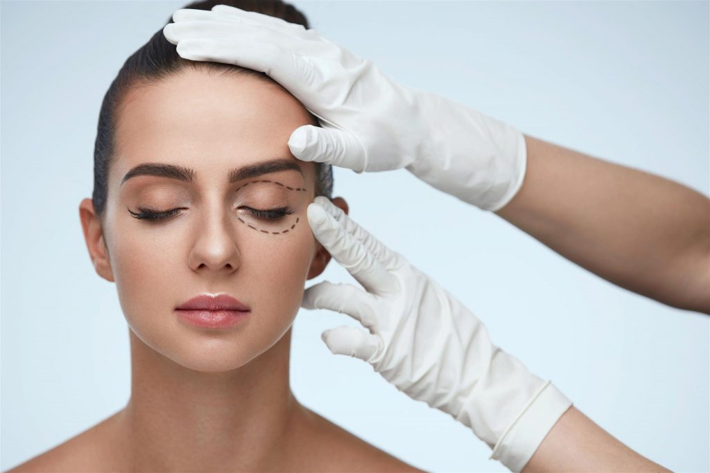 blefaroplastia que es