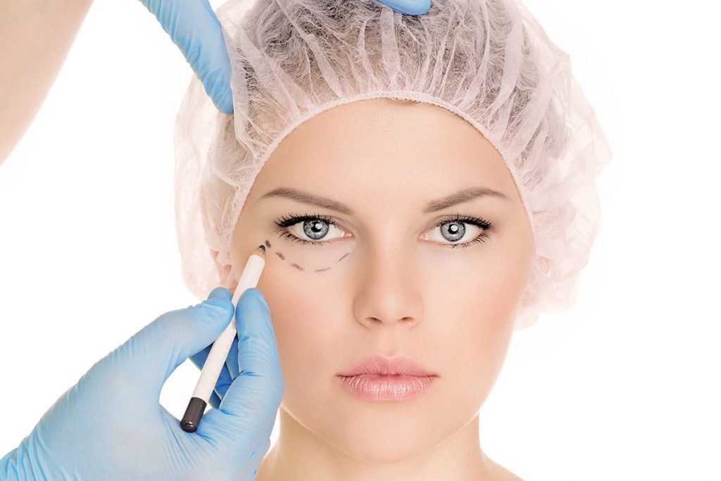 fotos de operaciones de blefaroplastia